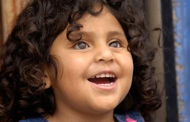 Compassion helps a blind girl from Ecuador get prosthetic eyes