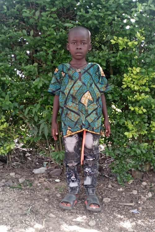 An unsponsored boy named Devis from Uganda who lives in an AIDS-affected area, is vulnerable to exploitation and has waited 335 days for a sponsor.