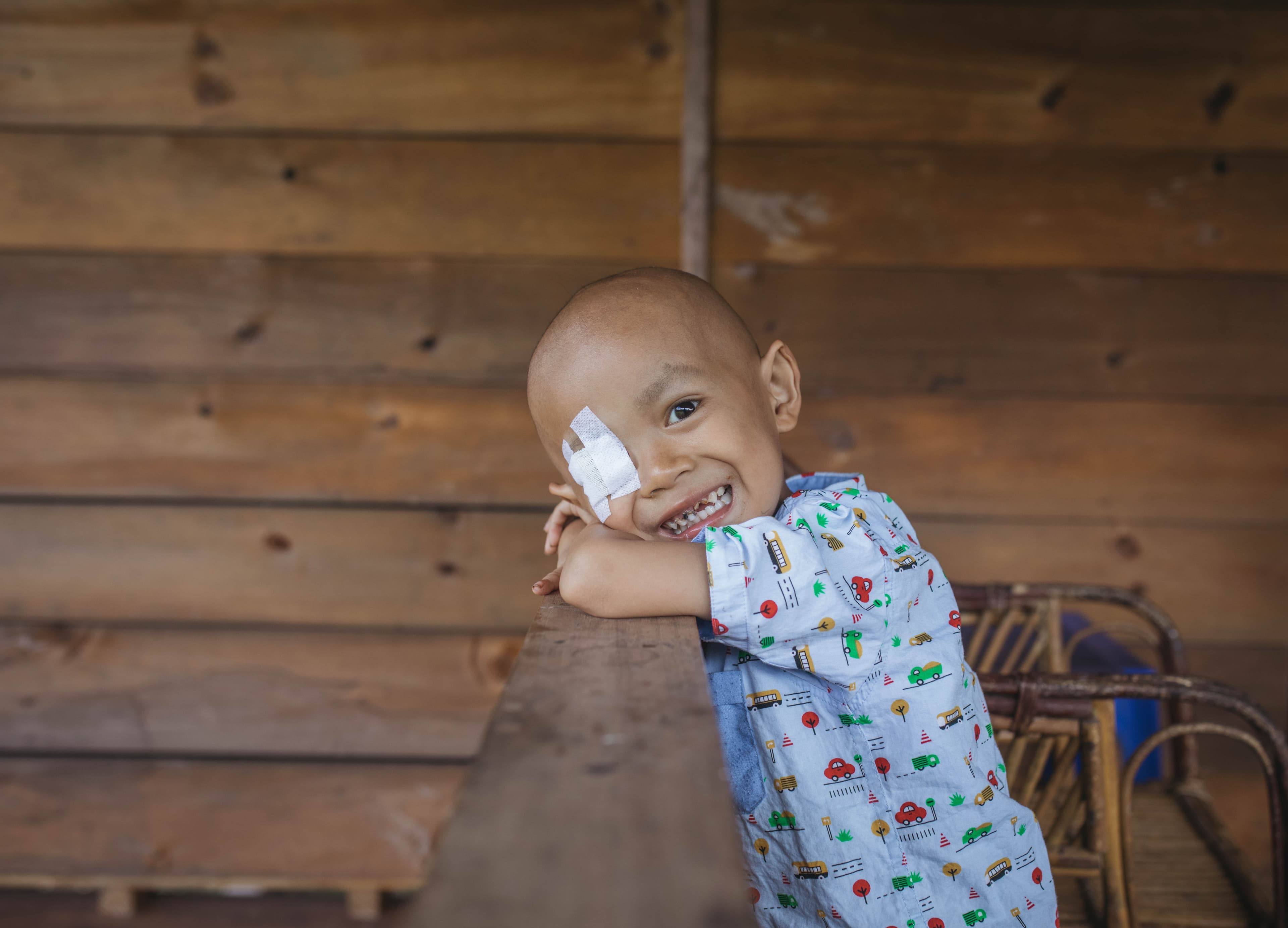 A toddler boy smiles with his head on his arms. He is wearing an eye patch and blue patterned shirt.