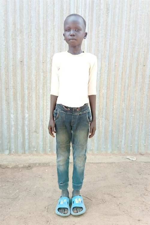 An unsponsored boy named Dobuol from Ethiopia who lives in an AIDS-affected area, is vulnerable to exploitation and has waited 406 days for a sponsor.